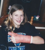 Jess showing off her broken thumb (playing B.B.) 2003